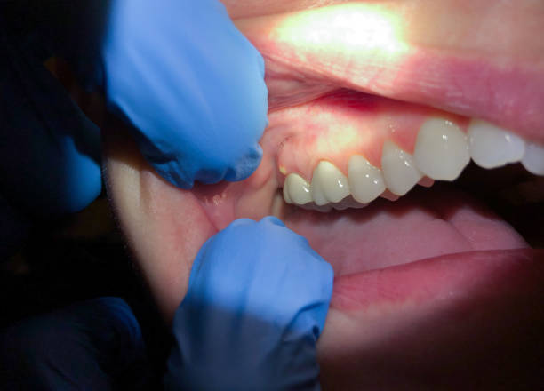 Best Emergency Treatment for Jaw Pain or Injury in Swarthmore, PA